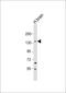 Membrane Associated Guanylate Kinase, WW And PDZ Domain Containing 3 antibody, MBS9215751, MyBioSource, Western Blot image 