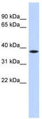Proline Rich 14 Like antibody, TA331394, Origene, Western Blot image 