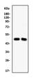 Secreted frizzled-related protein 4 antibody, PB9888, Boster Biological Technology, Western Blot image 