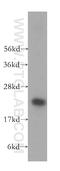 Pre-rRNA-processing protein TSR2 homolog antibody, 16263-1-AP, Proteintech Group, Western Blot image 