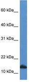 Cytidine Deaminase antibody, TA343116, Origene, Western Blot image 