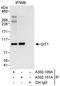 ARF GTPase-activating protein GIT1 antibody, A302-101A, Bethyl Labs, Immunoprecipitation image 