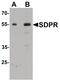 Caveolae Associated Protein 1 antibody, PA5-34522, Invitrogen Antibodies, Western Blot image 