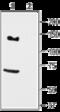 Potassium Voltage-Gated Channel Subfamily H Member 7 antibody, GTX16686, GeneTex, Western Blot image 
