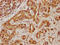Tensin 4 antibody, CSB-PA810319LA01HU, Cusabio, Immunohistochemistry frozen image 