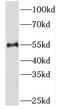 Protein Kinase, Membrane Associated Tyrosine/Threonine 1 antibody, FNab06497, FineTest, Western Blot image 