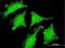 DND MicroRNA-Mediated Repression Inhibitor 1 antibody, H00373863-M08, Novus Biologicals, Immunofluorescence image 