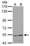 Histidyl-TRNA Synthetase antibody, NBP2-16781, Novus Biologicals, Western Blot image 
