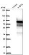 NEDD4 Binding Protein 3 antibody, NBP2-48511, Novus Biologicals, Western Blot image 