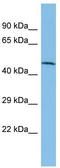 Folate Hydrolase 1 antibody, TA336088, Origene, Western Blot image 