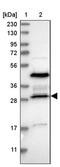 Ribosomal RNA Processing 15 Homolog antibody, PA5-55134, Invitrogen Antibodies, Western Blot image 