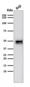 CD79a antibody, NBP2-54608, Novus Biologicals, Western Blot image 
