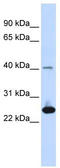 Selenoprotein S antibody, TA346517, Origene, Western Blot image 