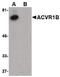 Activin A Receptor Type 1 antibody, PA5-20596, Invitrogen Antibodies, Western Blot image 