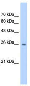 Ras Suppressor Protein 1 antibody, TA346616, Origene, Western Blot image 