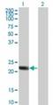 Regulator of G-protein signaling 5 antibody, NBP2-24945, Novus Biologicals, Western Blot image 