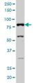 A-Kinase Anchoring Protein 17A antibody, H00008227-M02, Novus Biologicals, Western Blot image 