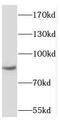 RNA Binding Motif Protein 28 antibody, FNab07173, FineTest, Western Blot image 