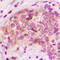 Mitochondrial Pyruvate Carrier 1 antibody, LS-C356186, Lifespan Biosciences, Immunohistochemistry paraffin image 