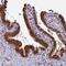 Hormonally Up-Regulated Neu-Associated Kinase antibody, HPA027372, Atlas Antibodies, Immunohistochemistry paraffin image 