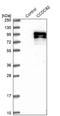 Coiled-Coil Domain Containing 82 antibody, NBP1-83583, Novus Biologicals, Western Blot image 