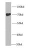 ZBP-1 antibody, FNab04171, FineTest, Western Blot image 