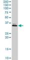 Short Chain Dehydrogenase/Reductase Family 16C Member 5 antibody, H00195814-D01P, Novus Biologicals, Western Blot image 