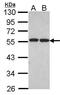 FAS-associated factor 2 antibody, PA5-21887, Invitrogen Antibodies, Western Blot image 