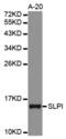 Secretory Leukocyte Peptidase Inhibitor antibody, abx001556, Abbexa, Western Blot image 