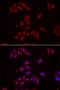 Nephrocystin-1 antibody, STJ28757, St John
