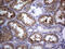 Chromosome 4 Open Reading Frame 36 antibody, M19586, Boster Biological Technology, Immunohistochemistry paraffin image 