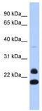 Neurogenin 2 antibody, TA345381, Origene, Western Blot image 