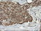 Phosphofructokinase, Platelet antibody, LS-C173569, Lifespan Biosciences, Immunohistochemistry paraffin image 
