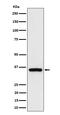 DNA repair protein RAD51 homolog 4 antibody, M02893, Boster Biological Technology, Western Blot image 