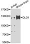 DLG1 antibody, LS-C747534, Lifespan Biosciences, Western Blot image 