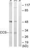 Copper Chaperone For Superoxide Dismutase antibody, abx014398, Abbexa, Western Blot image 