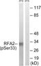 Replication Protein A2 antibody, P30447, Boster Biological Technology, Western Blot image 