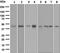 Small RNA Binding Exonuclease Protection Factor La antibody, ab124932, Abcam, Western Blot image 