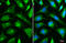 Hexokinase 2 antibody, GTX111525, GeneTex, Immunofluorescence image 