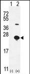 Epithelial Mitogen antibody, PA5-71499, Invitrogen Antibodies, Western Blot image 