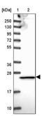 Proteasome Subunit Beta 3 antibody, PA5-60115, Invitrogen Antibodies, Western Blot image 