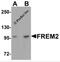 FRAS1 Related Extracellular Matrix 2 antibody, 5831, ProSci Inc, Western Blot image 