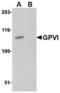 Platelet glycoprotein VI antibody, TA306632, Origene, Western Blot image 