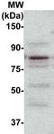 Protein kinase C beta type antibody, TA354429, Origene, Western Blot image 