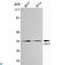 Cyclin Dependent Kinase 1 antibody, LS-C812908, Lifespan Biosciences, Western Blot image 