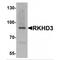 Mex-3 RNA Binding Family Member B antibody, MBS150066, MyBioSource, Western Blot image 