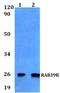 Ras-related protein Rab-39B antibody, A07186, Boster Biological Technology, Western Blot image 