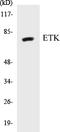 BMX Non-Receptor Tyrosine Kinase antibody, EKC1204, Boster Biological Technology, Western Blot image 