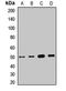 Succinate-CoA Ligase ADP-Forming Beta Subunit antibody, LS-C668561, Lifespan Biosciences, Western Blot image 
