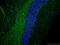Doublecortin antibody, 13925-1-AP, Proteintech Group, Immunofluorescence image 